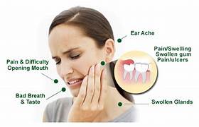 What is wisdom Tooth Removal?