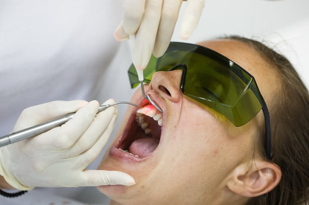 dental laser treatment